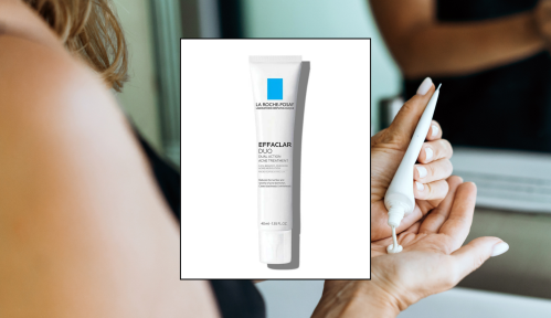 Collage image of person putting acne medication into their hand and the la roche-posay acne treatment that was recalled recently